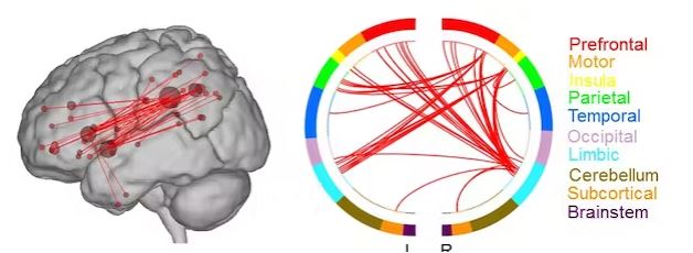 دو رندر لوب های مغز را نشان می دهد که در شبکه خلاقانه بالا به هم متصل هستند. نویسنده ارائه شده است